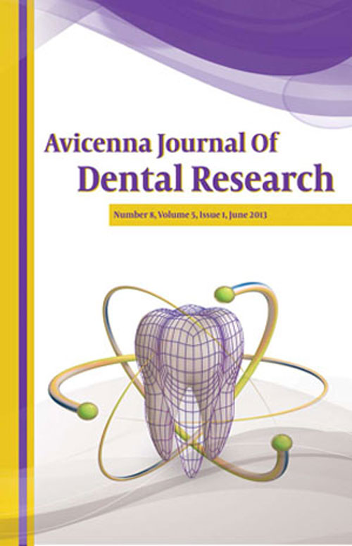 Avicenna Journal of Dental Research - Volume:8 Issue: 2, Jun 2016
