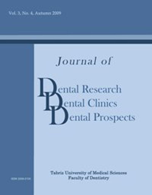 Dental Research, Dental Clinics, Dental Prospects - Volume:10 Issue: 3, Summer 2016