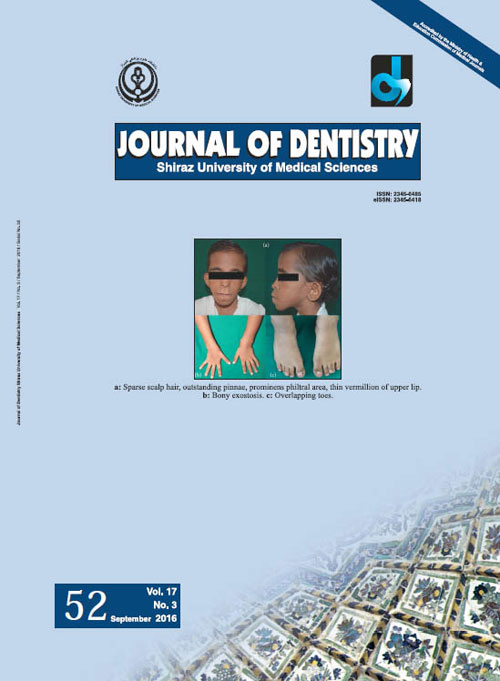 Dentistry, Shiraz University of Medical Sciences - Volume:17 Issue: 3, Sep 2016