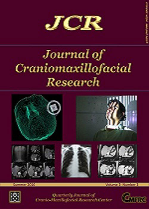 Craniomaxillofacial Research - Volume:3 Issue: 2, Spring 2016