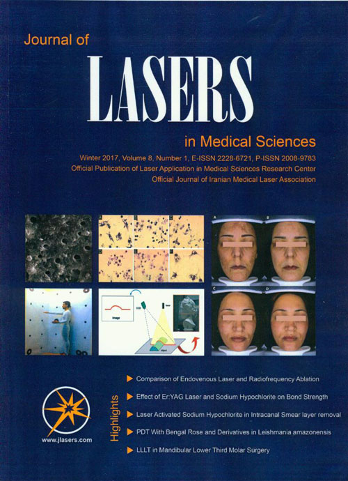 Lasers in Medical Sciences - Volume:8 Issue: 1, Winter 2017