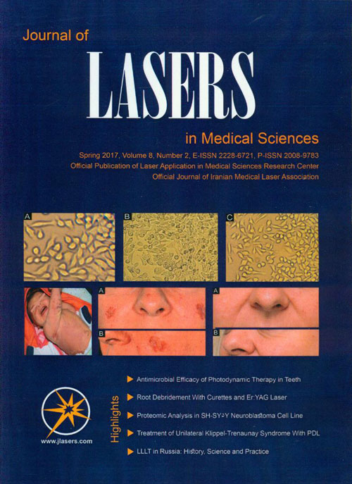 Lasers in Medical Sciences - Volume:8 Issue: 2, Spring 2017