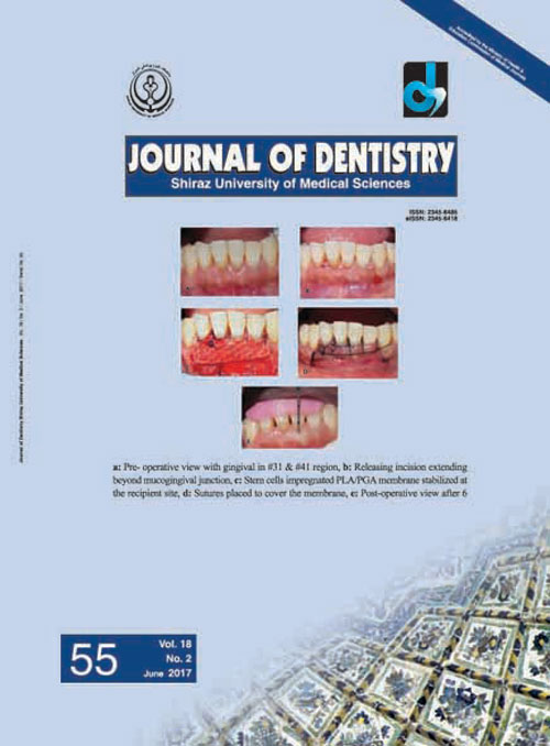 Dentistry, Shiraz University of Medical Sciences - Volume:18 Issue: 2, Jun 2017