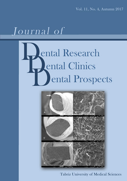 Dental Research, Dental Clinics, Dental Prospects - Volume:11 Issue: 4, Autumn 2017
