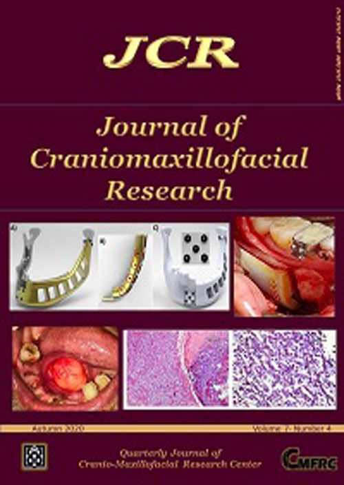Craniomaxillofacial Research - Volume:8 Issue: 1, Winter 2021