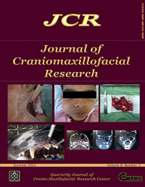 Craniomaxillofacial Research - Volume:8 Issue: 3, Summer 2021