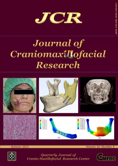 Craniomaxillofacial Research - Volume:10 Issue: 4, Autumn 2023