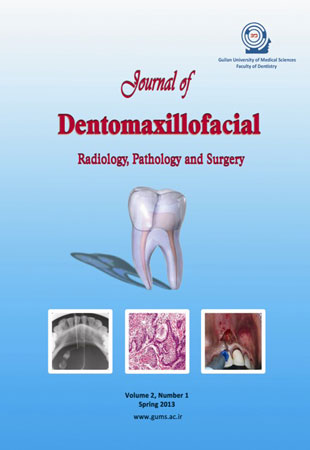 Dentomaxillofacil Radiology, Pathology and Surgery - Volume:2 Issue: 1, Spring 2013