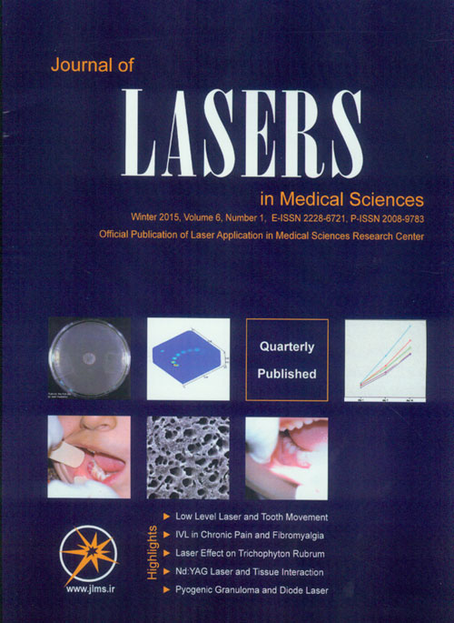 Lasers in Medical Sciences - Volume:6 Issue: 1, Winter 2015