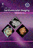 Archives Of Cardiovascular Imaging - Volume:3 Issue: 3, Aug 2015