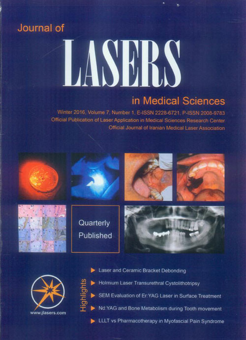 Lasers in Medical Sciences - Volume:7 Issue: 1, Winter 2016