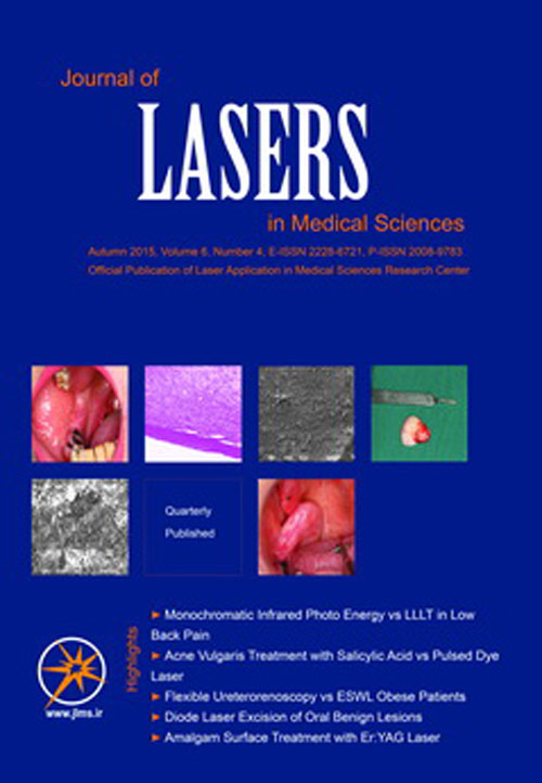 Lasers in Medical Sciences - Volume:7 Issue: 3, Summer 2016