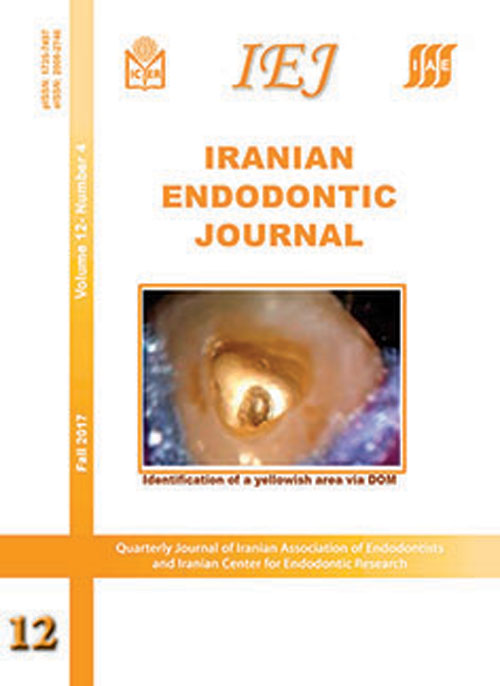 Iranian Endodontic Journal - Volume:12 Issue: 4, Fall 2017