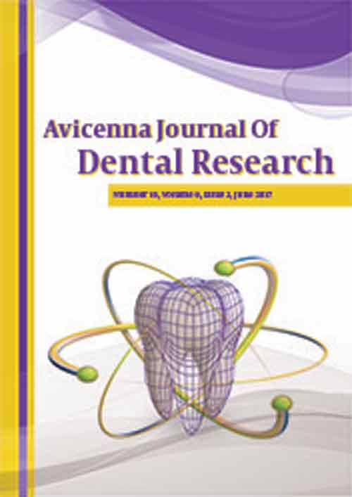 Avicenna Journal of Dental Research - Volume:9 Issue: 2, Jun 2017