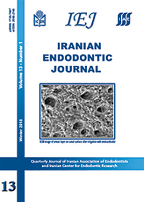 Iranian Endodontic Journal - Volume:13 Issue: 1, Winter 2018