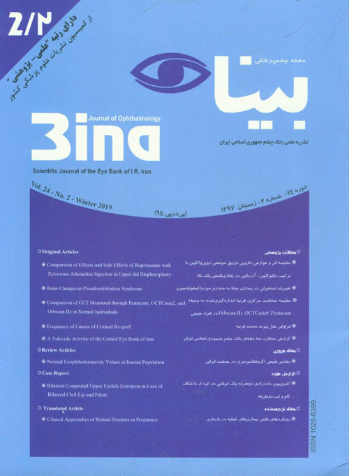 چشم پزشکی بینا - سال بیست و چهارم شماره 2 (زمستان 1397)
