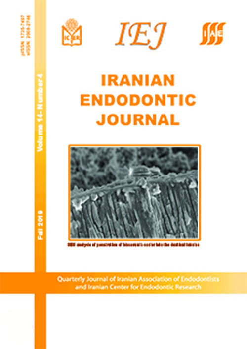 Iranian Endodontic Journal - Volume:16 Issue: 2, Spring 2021