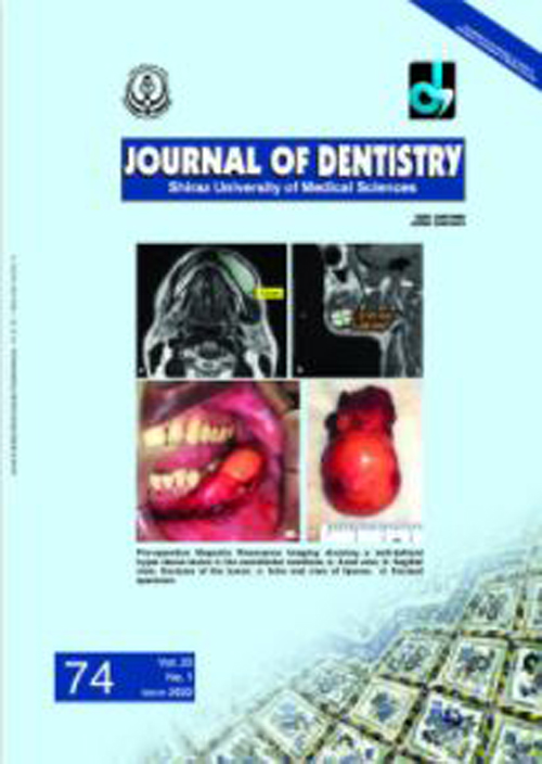 Dentistry, Shiraz University of Medical Sciences - Volume:23 Issue: 1, Mar 2022