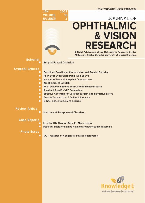 Ophthalmic and Vision Research - Volume:18 Issue: 2, Apr-Jun 2023