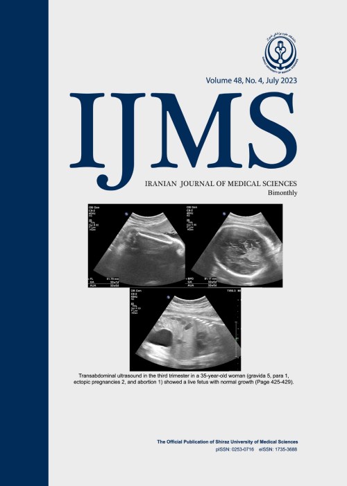 Medical Sciences - Volume:48 Issue: 4, Jul 2023