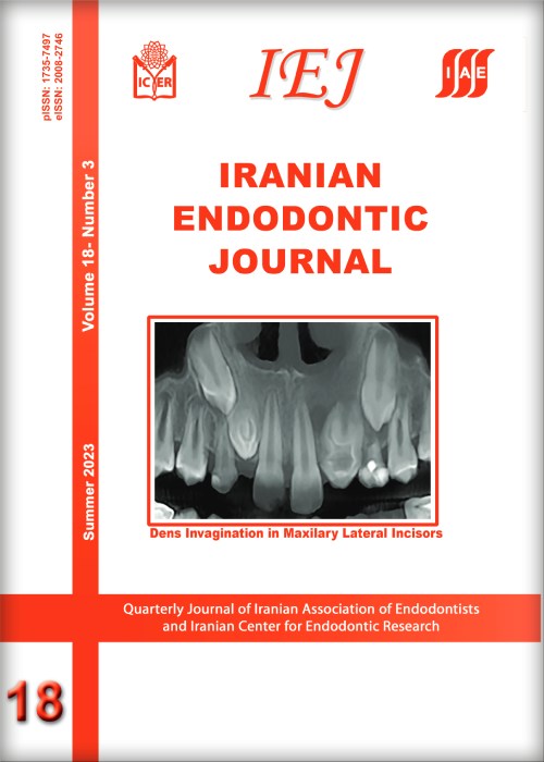 Iranian Endodontic Journal - Volume:18 Issue: 3, Summer 2023