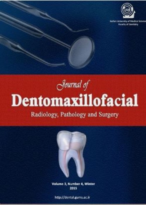 Dentomaxillofacil Radiology, Pathology and Surgery - Volume:12 Issue: 2, Spring 2023