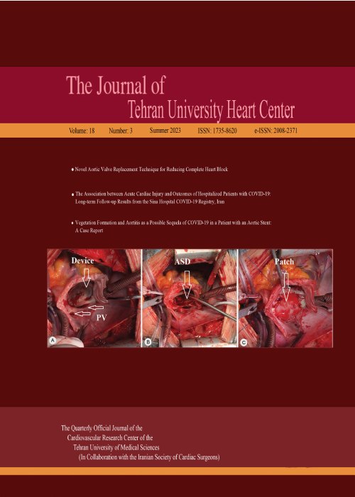 Tehran University Heart Center - Volume:18 Issue: 3, Jul 2023