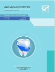 دانشکده دندان پزشکی اصفهان - سال نوزدهم شماره 2 (پیاپی 83، تابستان 1402)