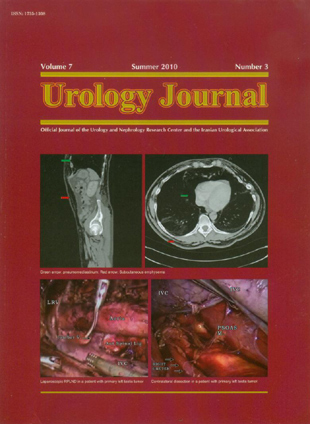 Urology Journal - Volume:7 Issue: 3, Summer 2010