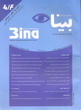 چشم پزشکی بینا - سال پانزدهم شماره 4 (تابستان 1389)