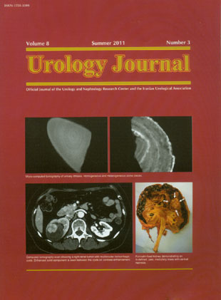 Urology Journal - Volume:8 Issue: 3, Summer 2011