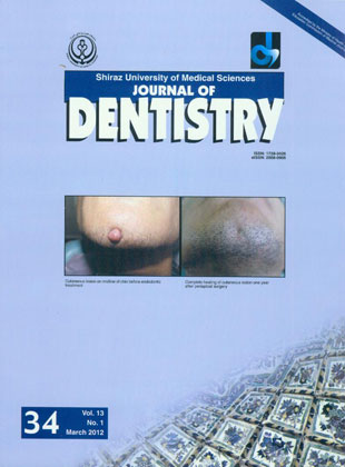 Dentistry, Shiraz University of Medical Sciences - Volume:13 Issue: 1, 2012
