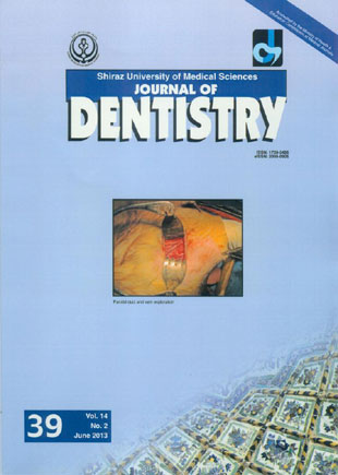 Dentistry, Shiraz University of Medical Sciences - Volume:14 Issue: 2, Jun 2013
