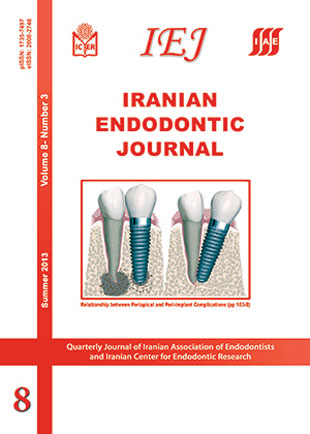 Iranian Endodontic Journal - Volume:8 Issue: 3, Summer 2013