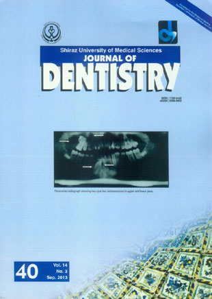 Dentistry, Shiraz University of Medical Sciences - Volume:14 Issue: 3, Sep 2013