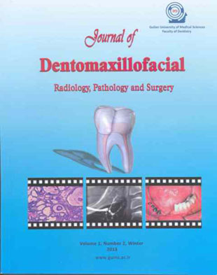 Dentomaxillofacil Radiology, Pathology and Surgery - Volume:2 Issue: 2, Summer 2013