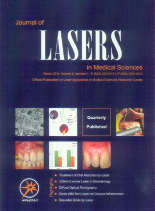 Lasers in Medical Sciences - Volume:5 Issue: 1, Winter 2014
