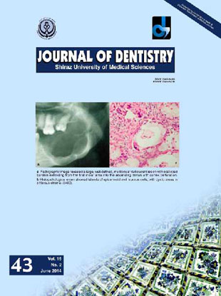 Frontiers in Dentistry - Volume:11 Issue: 1, Jan 2014